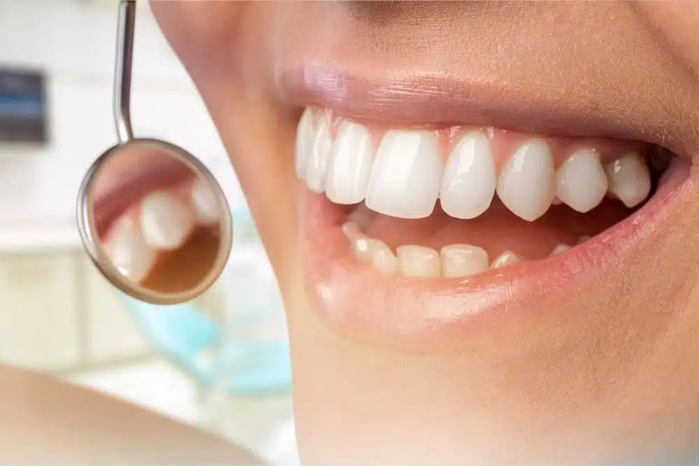 Are Dental Bone Grafts Painful?