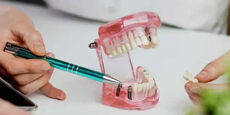 dentalimplants_0001_AdobeStock_397039410.jpg