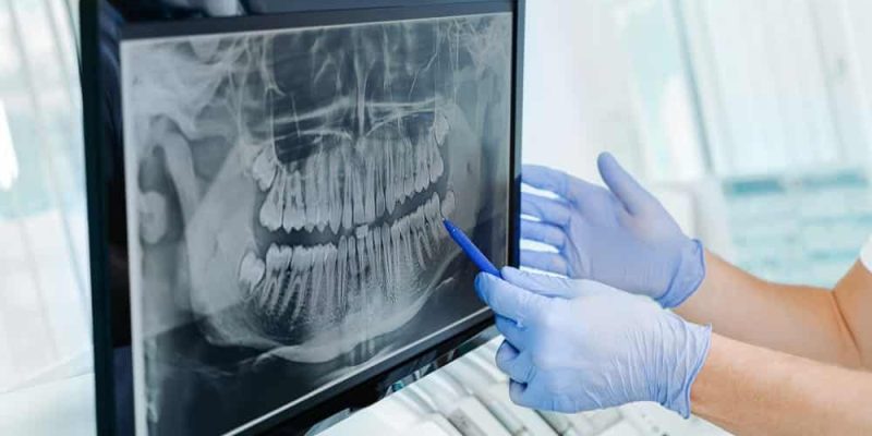 Hands,Doctor,Dentist,In,Gloves,Show,The,Teeth,On,X-ray
