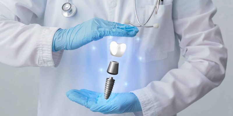 Dentist,With,Digital,Model,Of,Tooth,Implant,On,Light,Background,